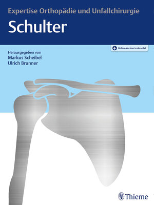 cover image of Expertise Schulter